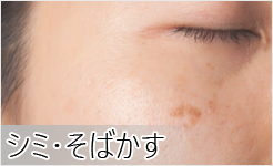 シミ