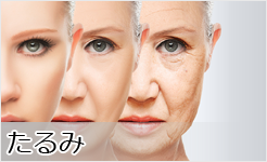 たるみ
